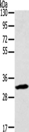 Western Blot analysis of Mouse lung tissue using STX11 Polyclonal Antibody at dilution of 1:400