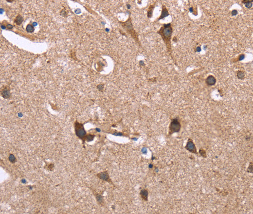 Immunohistochemistry of paraffin-embedded Human brain  using SERPINA1 Polyclonal Antibody at dilution of 1:30