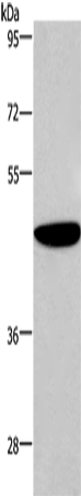 Western Blot analysis of Human fetal brain tissue using ABI1 Polyclonal Antibody at dilution of 1:300