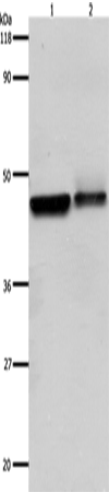 Western Blot analysis of Hela and A549 cell using ADRB2 Polyclonal Antibody at dilution of 1:600