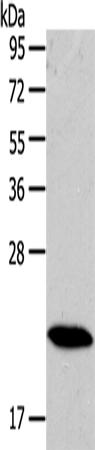 Western Blot analysis of Mouse heart tissue using RAB18 Polyclonal Antibody at dilution of 1:400