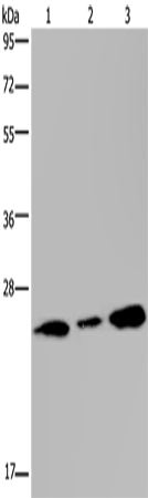 Western Blot analysis of Human fetal brain tissue and 293T cell using RAB3c Polyclonal Antibody at dilution of 1:400