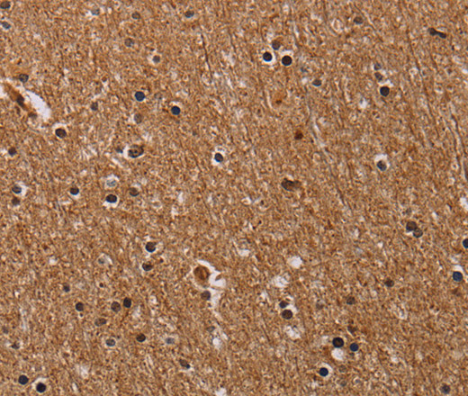 Immunohistochemistry of paraffin-embedded Human brain  tissue using FABP3 Polyclonal Antibody at dilution 1:40