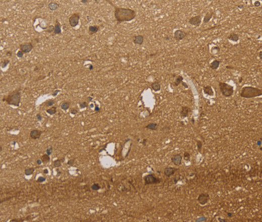 Immunohistochemistry of paraffin-embedded Human brain  tissue using CSNK2B Polyclonal Antibody at dilution 1:30