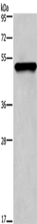 Western Blot analysis of Mouse skin tissue using CK-14 Polyclonal Antibody at dilution of 1:1350