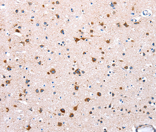 Immunohistochemistry of paraffin-embedded Human brain tissue using NDUFA12 Polyclonal Antibody at dilution 1:50