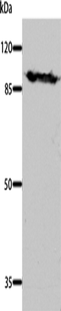 Western Blot analysis of Mouse brain tissue using DNM1 Polyclonal Antibody at dilution of 1:700