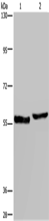 Western Blot analysis of Human testis tissue and A375 cell using SLC1A6 Polyclonal Antibody at dilution of 1:400