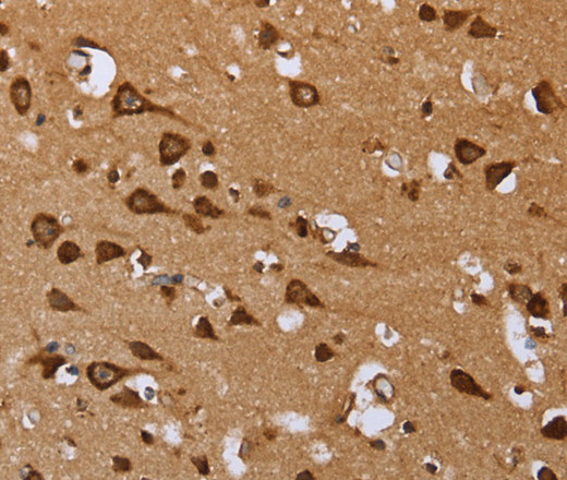 Immunohistochemistry of paraffin-embedded Human brain  tissue using EPOR Polyclonal Antibody at dilution 1:40