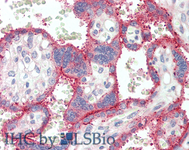 Immunohistochemistry of paraffin-embedded Placenta tissue using EPOR Polyclonal Antibody at dilution of 1:70.