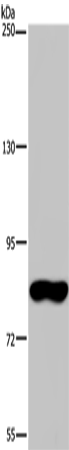 Western Blot analysis of Hela cell using FAF1 Polyclonal Antibody at dilution of 1:400
