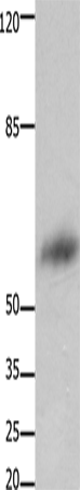 Western Blot analysis of Human liver cancer tissue using FOXJ3 Polyclonal Antibody at dilution of 1:800