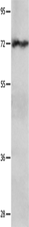 Western Blot analysis of Hela cell   using IGF2BP1 Polyclonal Antibody at dilution of 1:750