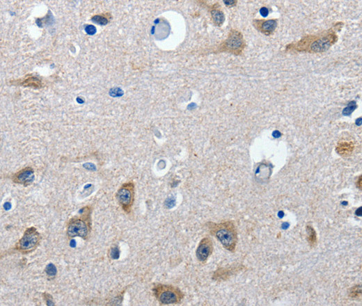 Immunohistochemistry of paraffin-embedded Human brain  tissue using GAD2  Polyclonal Antibody at dilution 1:30