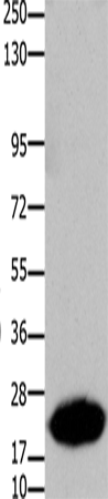 Western Blot analysis of Human liver cancer tissue using Claudin 7 Polyclonal Antibody at dilution of 1:1050