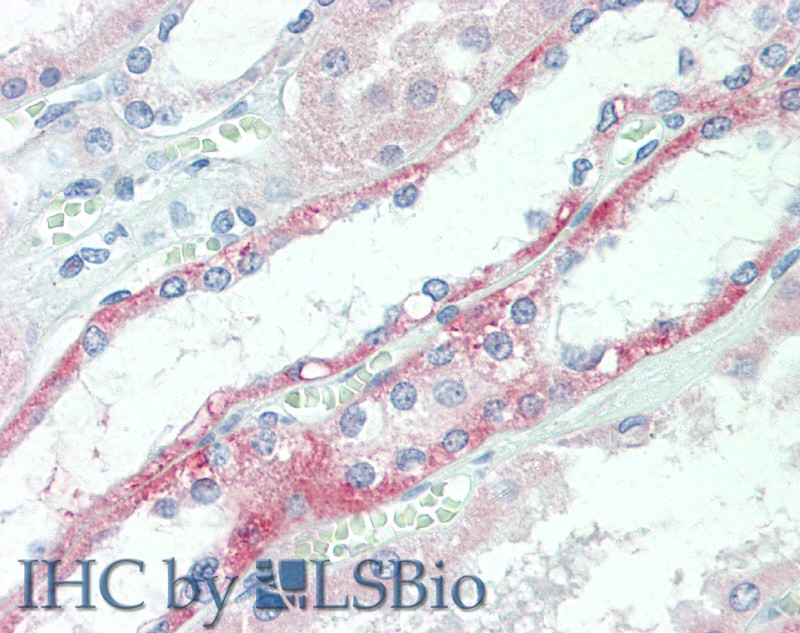 Immunohistochemistry of paraffin-embedded Kidney tissue using Claudin 10 Polyclonal Antibody at dilution of 1:60.