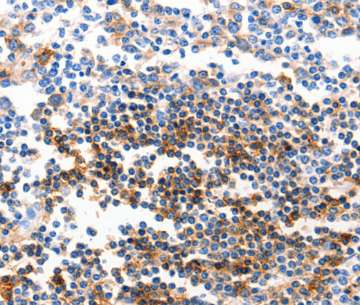 Immunohistochemistry of paraffin-embedded Human tonsil tissue using GJB6 Polyclonal Antibody at dilution 1:40