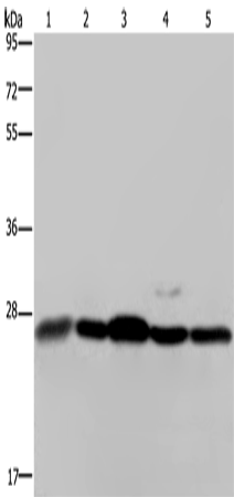 Western Blot analysis of Human hepatocellular carcinoma tissue, Hela and Jurkat cell, 293T cell and Human breast infiltRative duct tissue using HMGB1 Polyclonal Antibody at dilution of 1:200