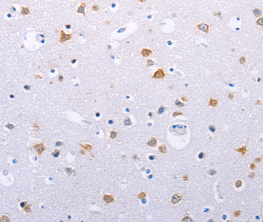 Immunohistochemistry of paraffin-embedded Human brain using HMGB3 Polyclonal Antibody at dilution of 1:30