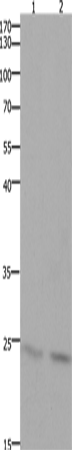 Western Blot analysis of Mouse lung and brain tissue using HMGB3 Polyclonal Antibody at dilution of 1:700