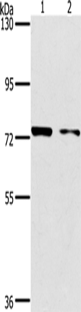 Western Blot analysis of MCF7 and hela cell using PPP1R13L Polyclonal Antibody at dilution of 1:500