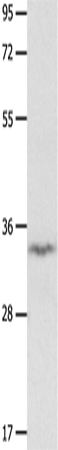 Western Blot analysis of Mouse brain tissue using IGFBP7 Polyclonal Antibody at dilution of 1:400