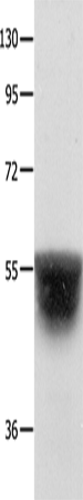 Western Blot analysis of Human brain malignant glioma tissue   using KCNA1 Polyclonal Antibody at dilution of 1:400