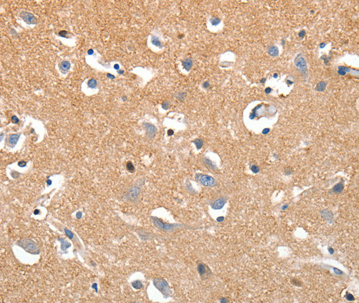 Immunohistochemistry of paraffin-embedded Human brain tissue using LRP3 Polyclonal Antibody at dilution 1:80