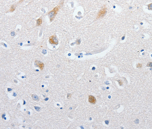 Immunohistochemistry of paraffin-embedded Human brain tissue using MATN1 Polyclonal Antibody at dilution 1:60