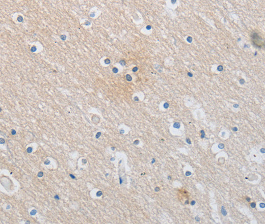 Immunohistochemistry of paraffin-embedded Human brain  using SLC16A7 Polyclonal Antibody at dilution of 1:30