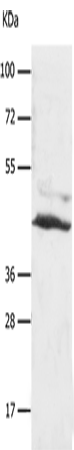 Western Blot analysis of A549 cell using SLC16A7 Polyclonal Antibody at dilution of 1:450