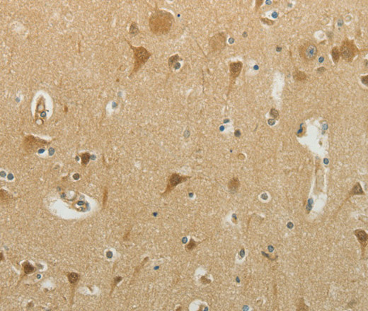 Immunohistochemistry of paraffin-embedded Human brain using MCM4 Polyclonal Antibody at dilution of 1:40