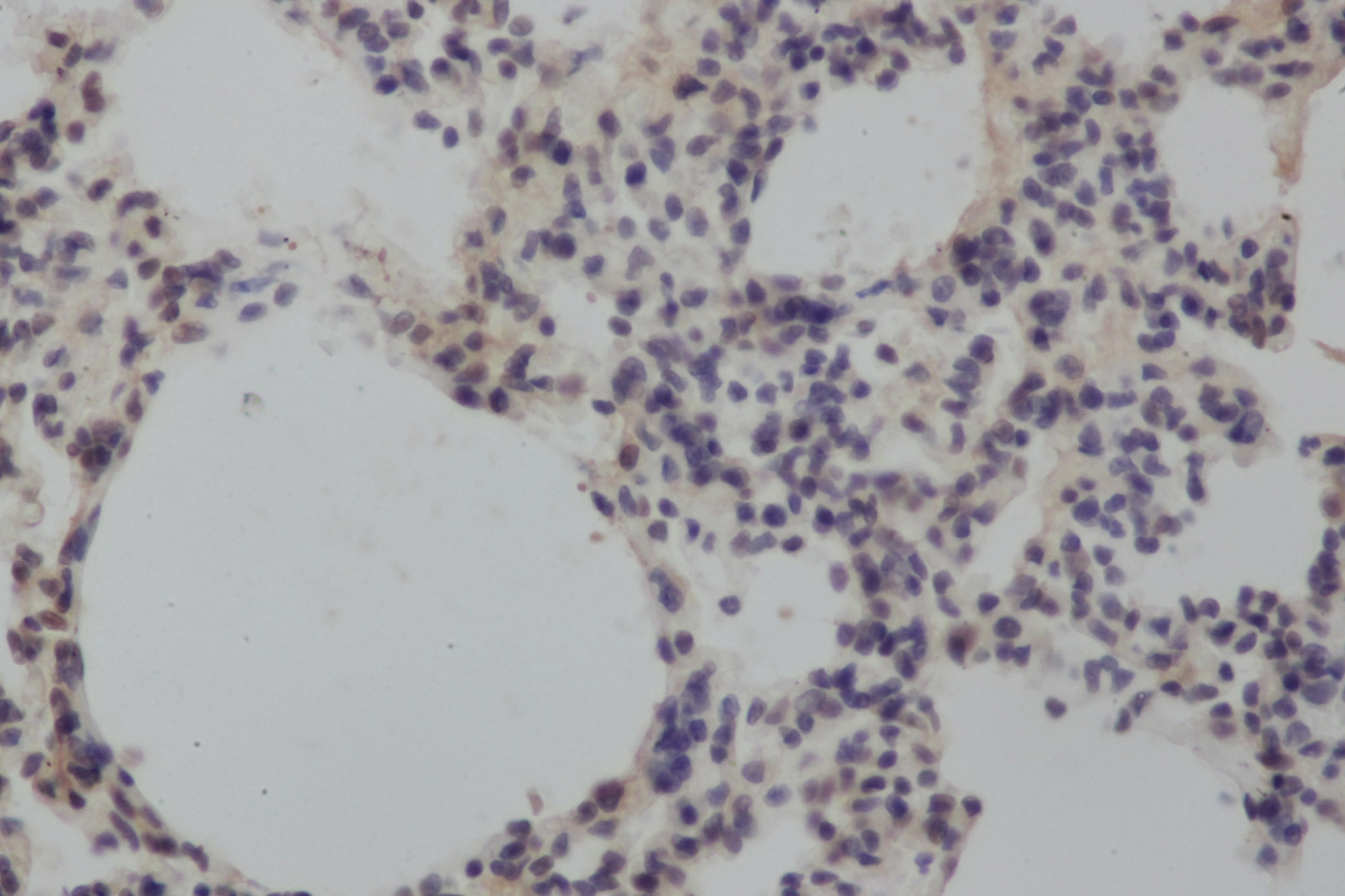 Immunohistochemistry of paraffin-embedded Rat lung using MMP8 Polyclonal Antibody at dilution of 1:50