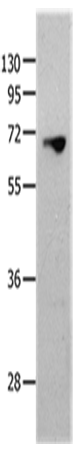 Western Blot analysis of 823 cell using MMP25 Polyclonal Antibody at dilution of 1:1300