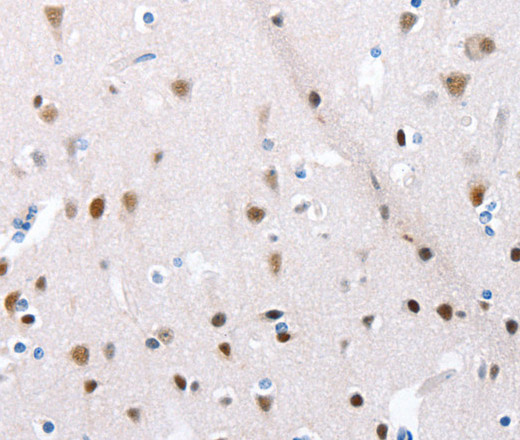 Immunohistochemistry of paraffin-embedded Human brain  using POMC Polyclonal Antibody at dilution of 1:30