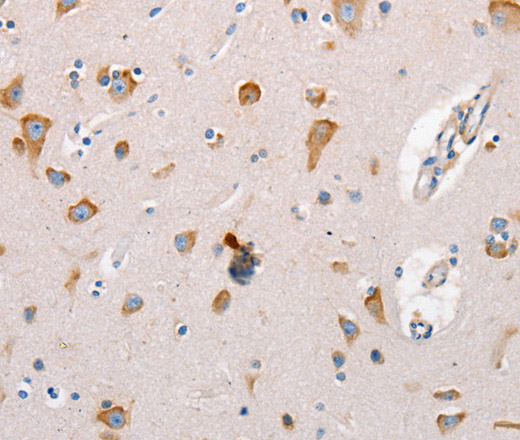 Immunohistochemistry of paraffin-embedded Human brain  tissue using MTOR Polyclonal Antibody at dilution 1:60