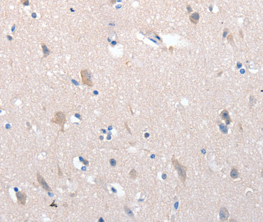 Immunohistochemistry of paraffin-embedded Human brain using YWHAG Polyclonal Antibody at dilution of 1:100