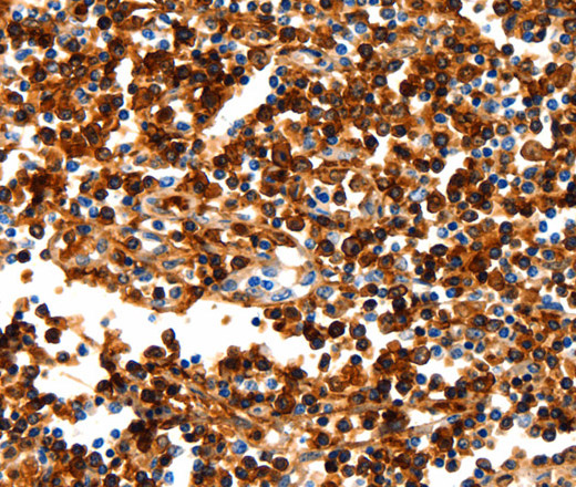 Immunohistochemistry of paraffin-embedded Human tonsil tissue using NCOR1 Polyclonal Antibody at dilution 1:100