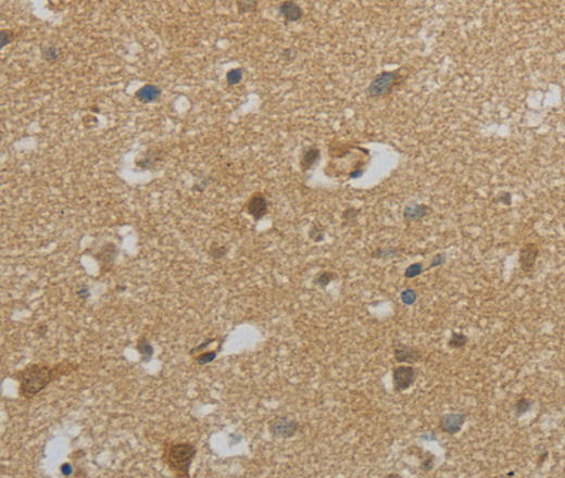 Immunohistochemistry of paraffin-embedded Human brain using NPHS1 Polyclonal Antibody at dilution of 1:40