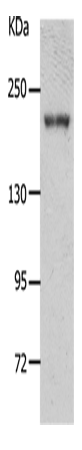 Western Blot analysis of Mouse kidney tissue using NPHS1 Polyclonal Antibody at dilution of 1:700