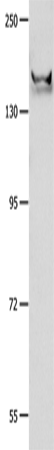 Western Blot analysis of Mouse brain tissue   using GRIN2B Polyclonal Antibody at dilution of 1:700