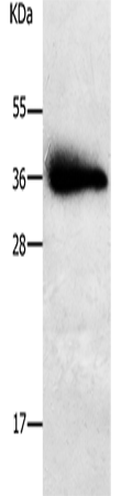 Western Blot analysis of Human liver cancer tissue using PLPP1 Polyclonal Antibody at dilution of 1:650