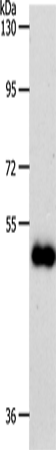 Western Blot analysis of Human colon cancer tissue using SLC39A6 Polyclonal Antibody at dilution of 1:500