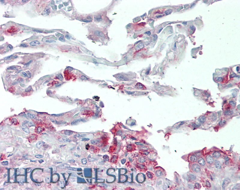 Immunohistochemistry of paraffin-embedded Human Lung tissue using SLC34A2 Polyclonal Antibody at dilution of 1:60.