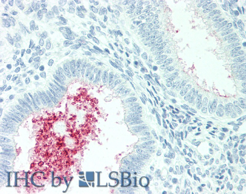 Immunohistochemistry of paraffin-embedded Human Uterus tissue using SLC34A2 Polyclonal Antibody at dilution of 1:60.