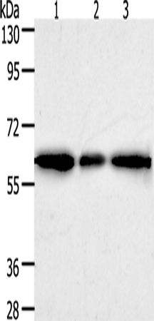 Western Blot analysis of Human liver cancer tissue, hela and 293T cell using AKR1A1 Polyclonal Antibody at dilution of 1:500