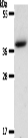 Western Blot analysis of Hela cell using AKR1B1 Polyclonal Antibody at dilution of 1:550