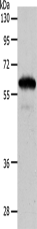 Western Blot analysis of Mouse brain tissue using INA Polyclonal Antibody at dilution of 1:550