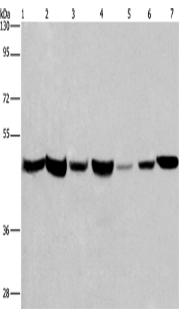 Western Blot analysis of Human placenta and fetal liver tissue, PC3, 231, Hela, HepG2 and A549 cell using APMAP Polyclonal Antibody at dilution of 1:300