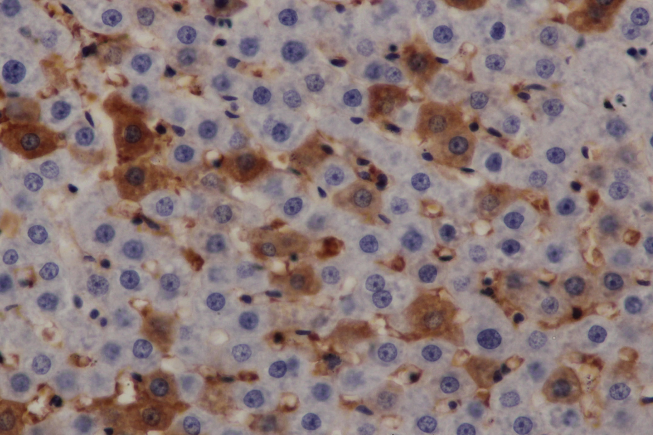 Immunohistochemistry of paraffin-embedded Rat liver using PRKD3 Polyclonal Antibody at dilution of 1:200